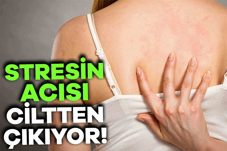 Günlük yaşantımızın kaçınılmaz bir parçası olarak kabul edilen stresin en