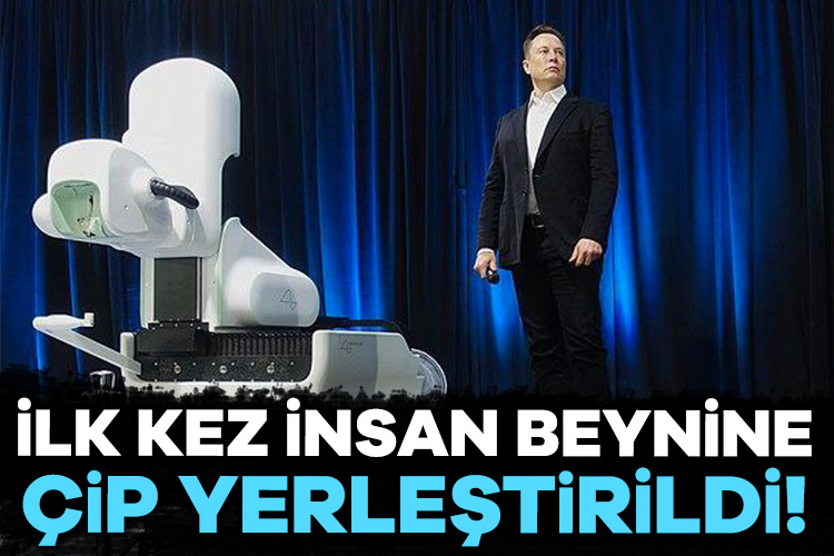 Elon Musk duyurdu: İlk kez insan beynine çip yerleştirildi! Tesla ile SpaceX’in kurucusu, sosyal medya platformu X’in sahibi Elon
