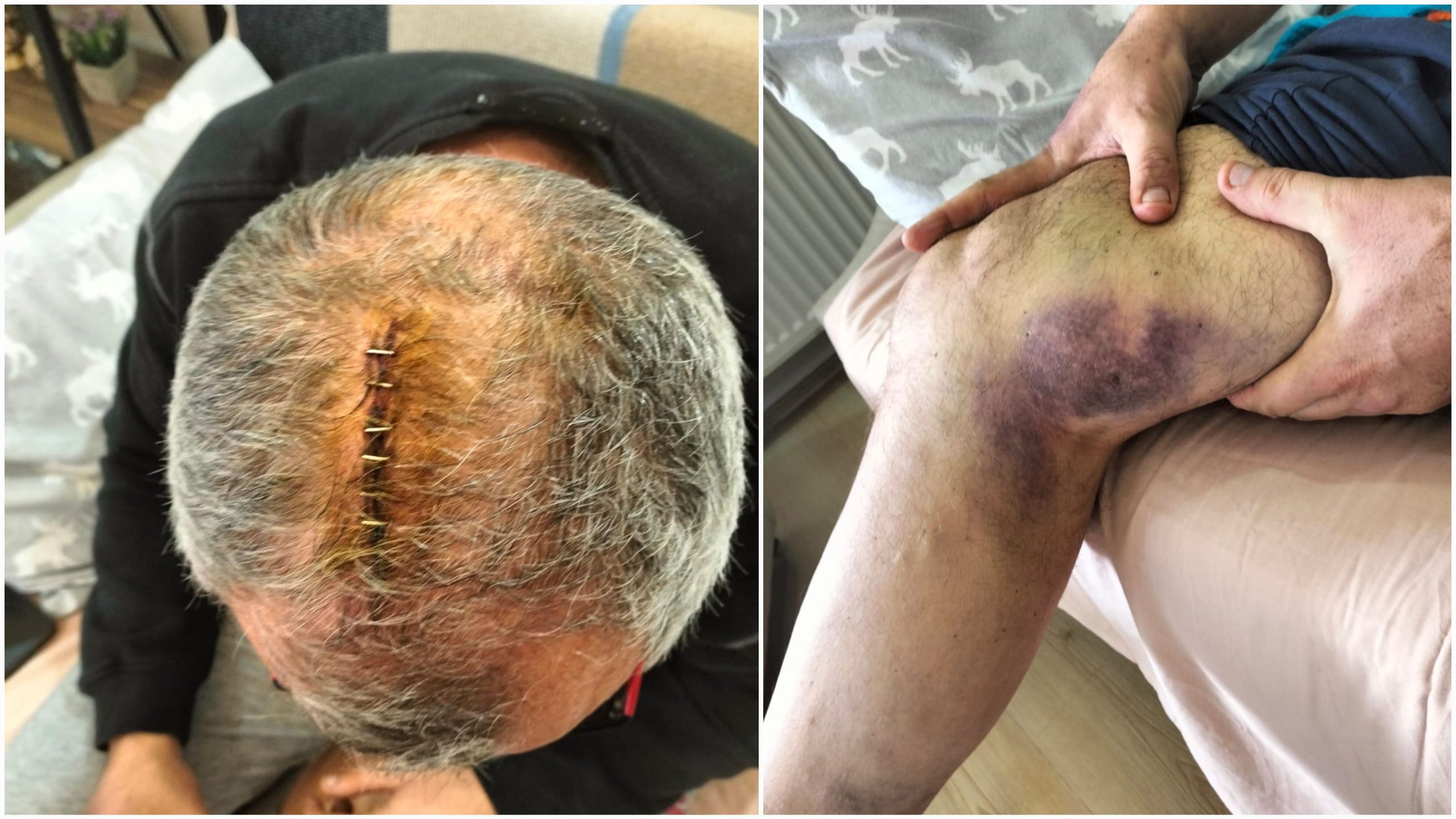 EĞİTİM SEN DARP EDİLEN ERDEKLİ EĞİTİMCİNİN YANINDA Sosyal medya hesabı üzerinden Erdek Belediyesi ile ilgili eleştiride bulunan