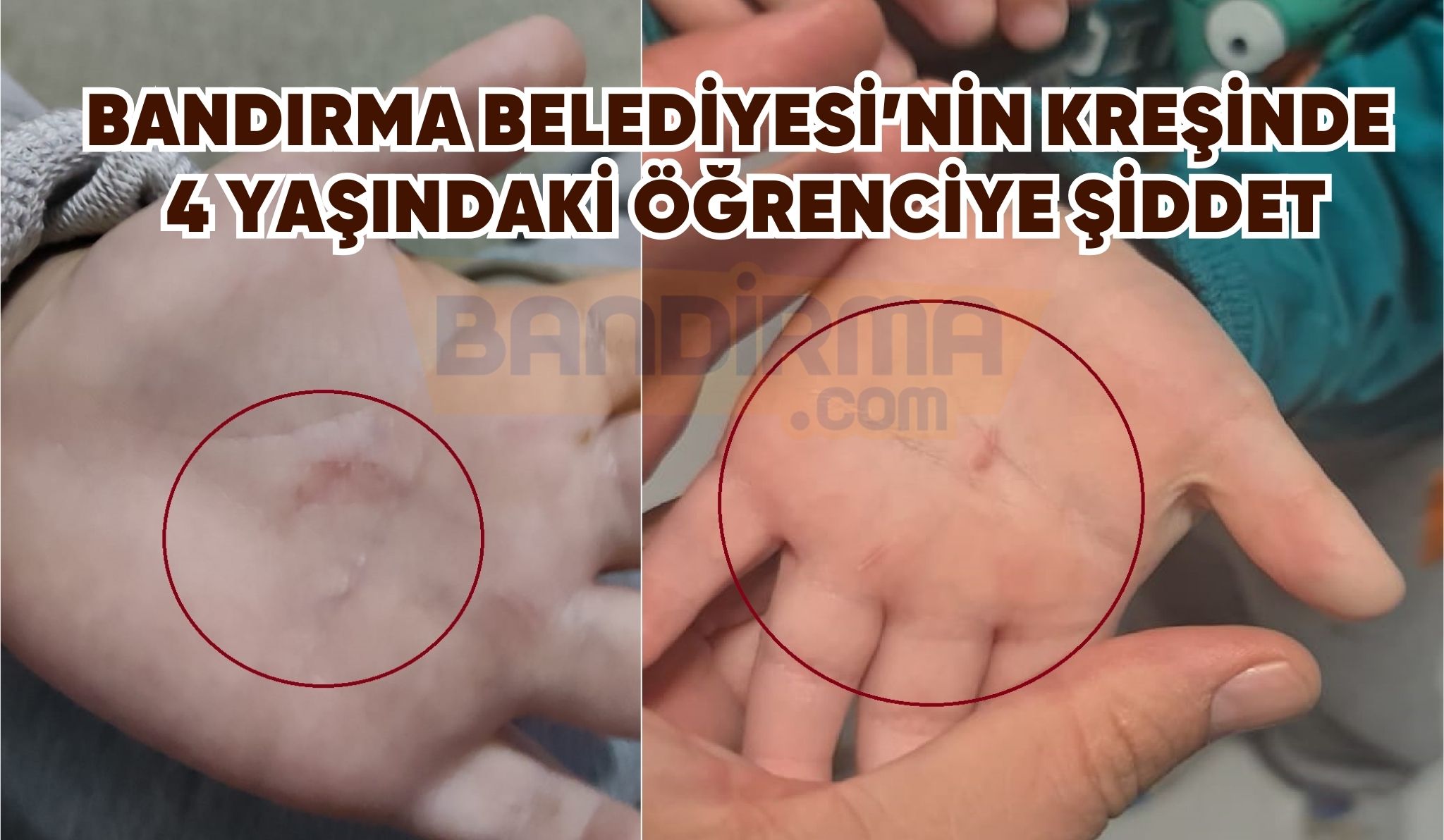 BANDIRMA BELEDİYESİ’NİN KREŞİNDE 4 YAŞINDAKİ ÖĞRENCİYE ŞİDDET Bandırma Belediyesi’nin Türkan Saylan Gündüz Bakım Evi’nde kan donduran cinsten