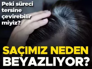 Saçların beyazlaması yaşlanmanın en göze çarpan belirtilerinden biri. Birçok kişi