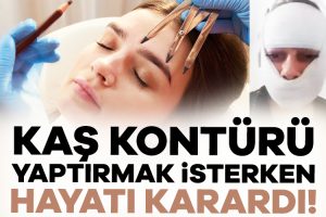 Estetik mağdurlarına bir yenisi daha eklendi. Ankara’da yaşayan Hatice Demir’in