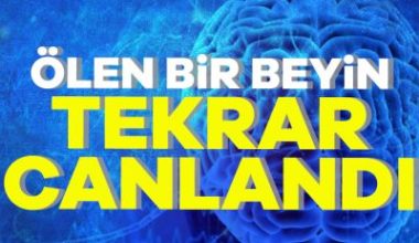 Araştırmacılar, ölü bir beyni yeniden canlandırma konusunda çığır açan bir