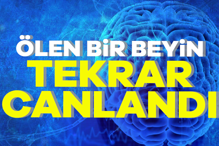 Araştırmacılar, ölü bir beyni yeniden canlandırma konusunda çığır açan bir
