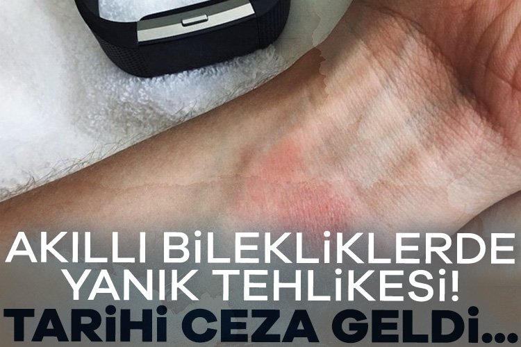 Akıllı bilekliklerde yanık tehlikesi! Tarihi ceza… Fitbit, 2022 yılında aşırı ısınma ve hatta üçüncü derece yanığa