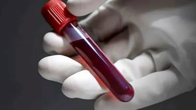 Yeni yapılan bir araştırma, kan grubunun sağlık üzerindeki önemli etkilerini