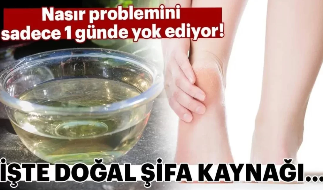 Birçok kişinin şikayetçi olduğu ve gün içerisinde sürekli acı çektiği