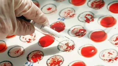 Yapılan araştırmalara göre bazı kan grupları için evlilikte risk büyük.