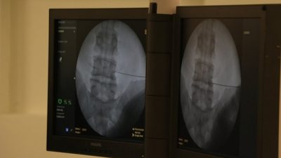 Nev Esentepe Hastanesi Nöroloji Uzmanı Dr. Damla Fındık, sık ve