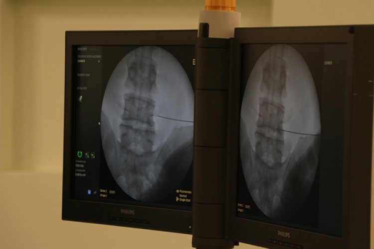 Nev Esentepe Hastanesi Nöroloji Uzmanı Dr. Damla Fındık, sık ve