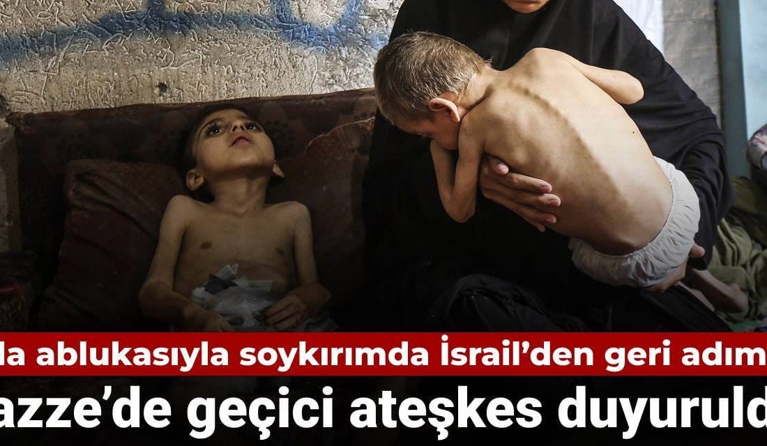 Gazze’de sivillere yönelik saldırılar ve açlık yoluyla uygulanan baskılar nedeniyle