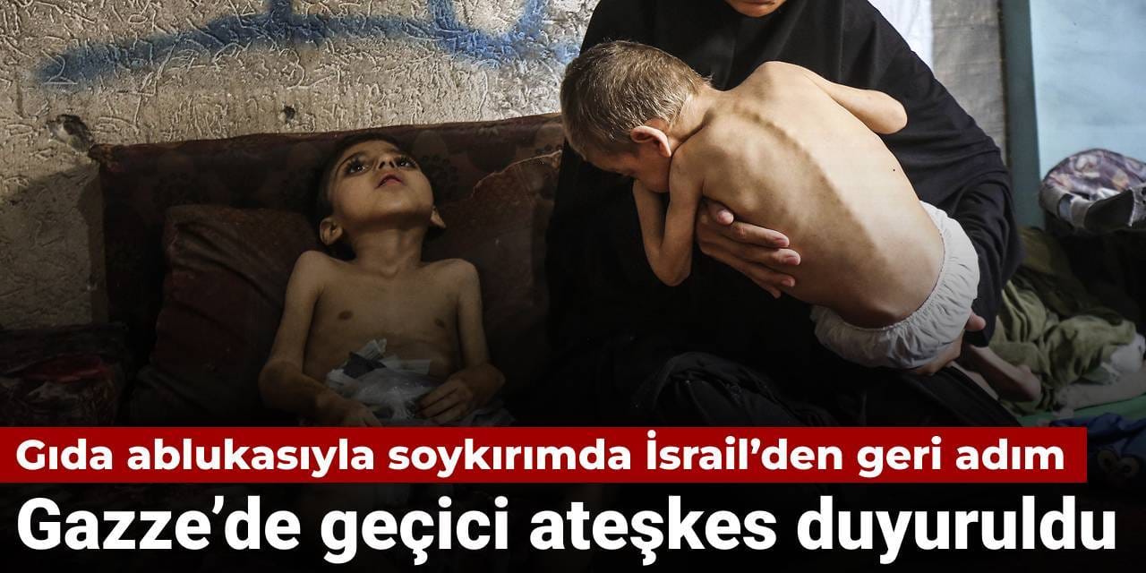 Gazze’de sivillere yönelik saldırılar ve açlık yoluyla uygulanan baskılar nedeniyle