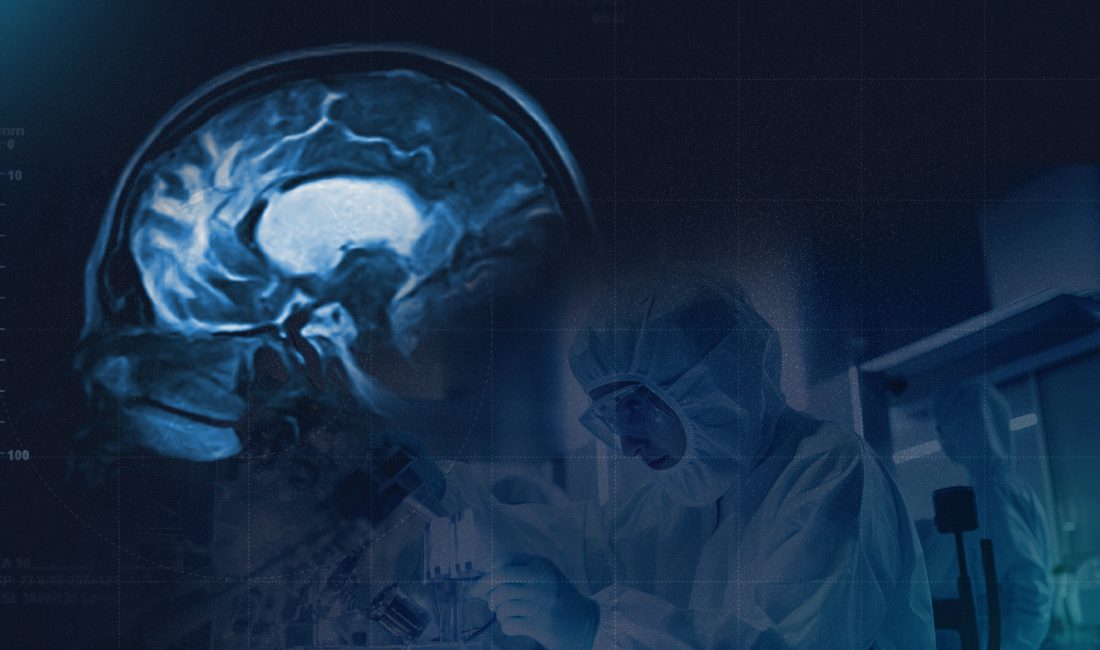 Alzheimer tedavisinde umut veren gelişme: SUL-238’in Faz 1 sonuçları açıklandı GEN İlaç ile Hollanda merkezli biyoteknoloji firması Sulfateq BV’nin birlikte